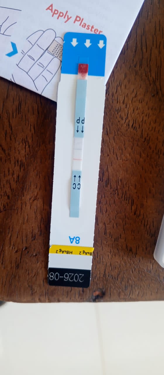 Kipimo cha homa ya ini [Hepatitis B surface Antigen]