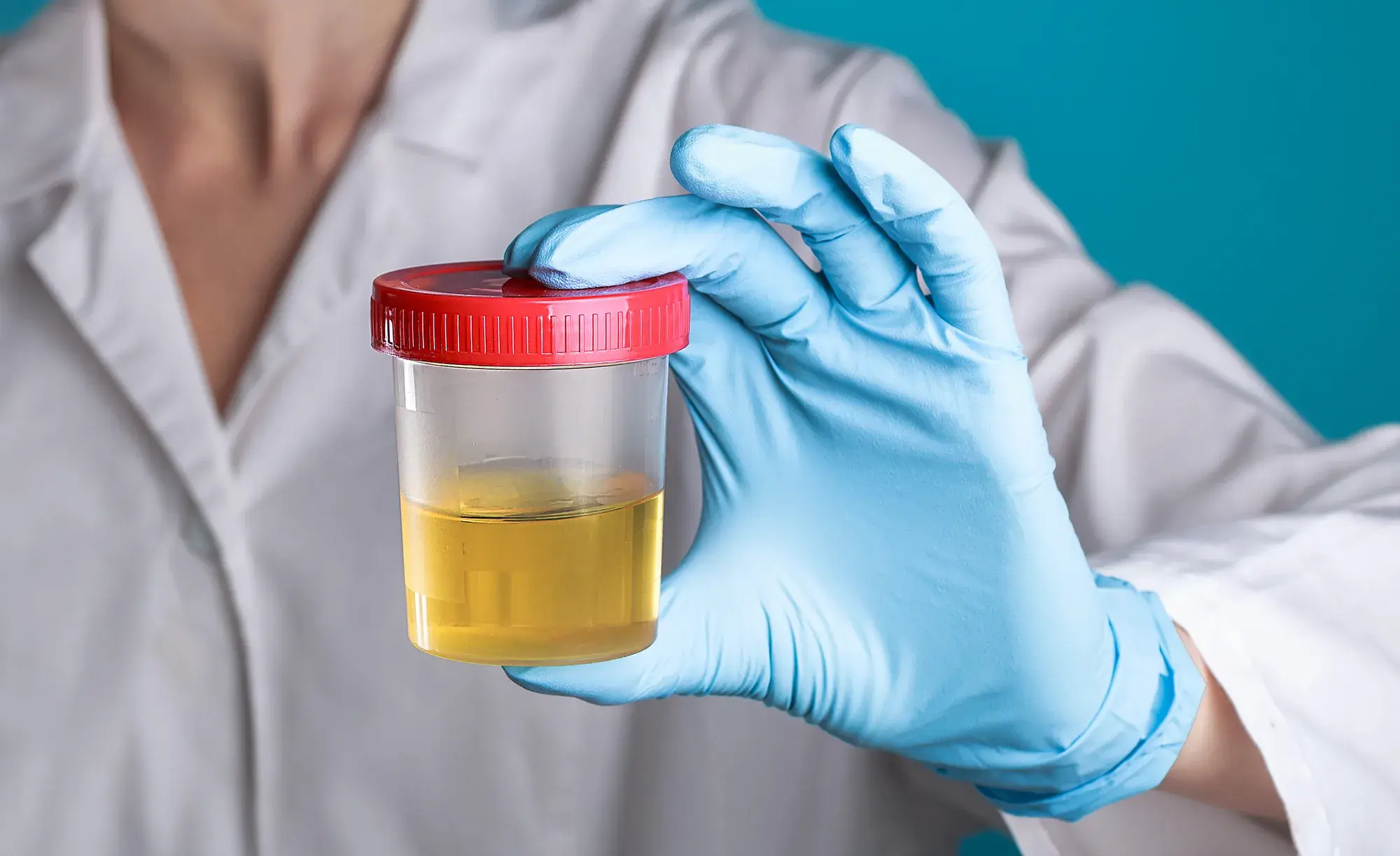 Magonjwa ya saratani, Visababishi, Dalili, Madhara, Vipimo na Matibabu